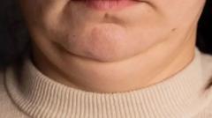 ma-ogtahay-dhumucda-qoortaada-in-ay-wax-badan-ka-sheegeyso-caafimaadkaaga?